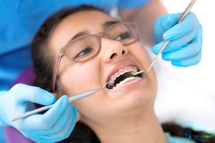 تقويم الاسنان قبل وبعد الفرق الذي يصنعه الابتسامة